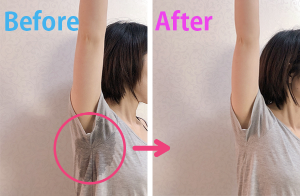 ワキガクリームおすすめ